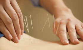 clinic-acupuncture-small